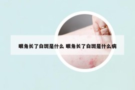 眼角長了白斑是什么 眼角長了白斑是什么病