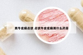 男牛皮癬點狀 點狀牛皮皮癬用什么藥膏