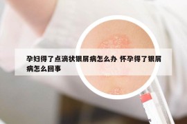 孕婦得了點滴狀銀屑病怎么辦 懷孕得了銀屑病怎么回事