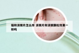 福和消銀片怎么樣 消銀片和消銀顆粒效果一樣嗎