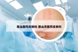 眉山醫(yī)院皮膚科 眉山市醫(yī)院皮膚科