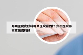 鄭州醫(yī)院皮膚科哪家醫(yī)院看的好 鄭州醫(yī)院哪家皮膚病科好