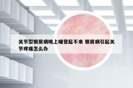 關(guān)節(jié)型銀屑病晚上睡覺起不來 銀屑病引起關(guān)節(jié)疼痛怎么辦