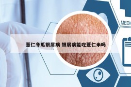 薏仁冬瓜銀屑病 銀屑病能吃薏仁米嗎