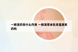一膚清藥膏什么作用 一膚清草本乳膏是激素藥嗎