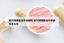 紫竹調(diào)理能治牛皮癬嗎 紫竹調(diào)理能治牛皮癬嗎怎么吃