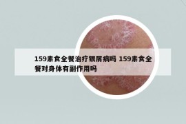 159素食全餐治療銀屑病嗎 159素食全餐對身體有副作用嗎