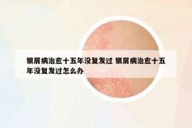銀屑病治愈十五年沒復發(fā)過 銀屑病治愈十五年沒復發(fā)過怎么辦