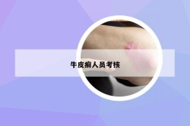 牛皮癬人員考核