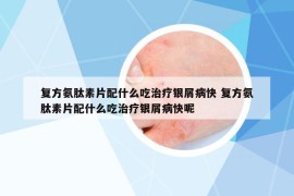 復(fù)方氨肽素片配什么吃治療銀屑病快 復(fù)方氨肽素片配什么吃治療銀屑病快呢