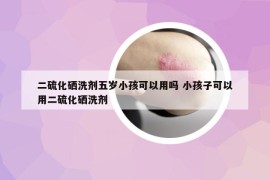 二硫化硒洗劑五歲小孩可以用嗎 小孩子可以用二硫化硒洗劑