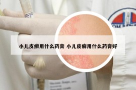 小兒皮癬用什么藥膏 小兒皮癬用什么藥膏好