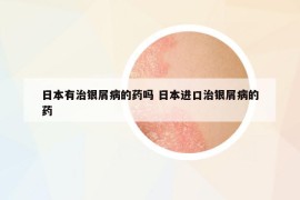 日本有治銀屑病的藥嗎 日本進(jìn)口治銀屑病的藥