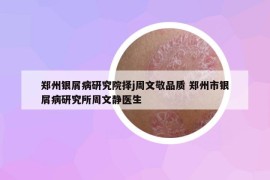 鄭州銀屑病研究院擇j周文敬品質(zhì) 鄭州市銀屑病研究所周文靜醫(yī)生
