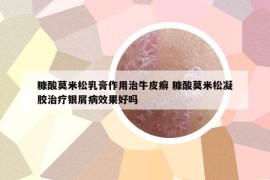 糠酸莫米松乳膏作用治牛皮癬 糠酸莫米松凝膠治療銀屑病效果好嗎