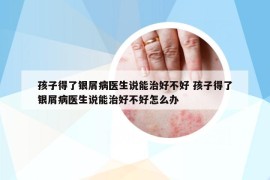 孩子得了銀屑病醫(yī)生說能治好不好 孩子得了銀屑病醫(yī)生說能治好不好怎么辦