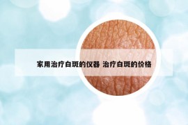 家用治療白斑的儀器 治療白斑的價格