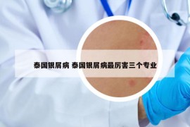泰國銀屑病 泰國銀屑病最厲害三個專業(yè)