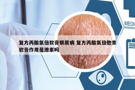復(fù)方丙酸氯倍軟膏銀屑病 復(fù)方丙酸氯倍他索軟膏作用是激素嗎