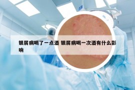銀屑病喝了一點酒 銀屑病喝一次酒有什么影響