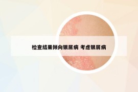 檢查結(jié)果傾向銀屑病 考慮銀屑病