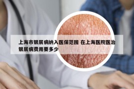 上海市銀屑病納入醫(yī)保范圍 在上海醫(yī)院醫(yī)治銀屑病費(fèi)用要多少