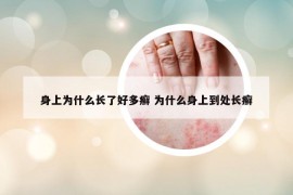 身上為什么長了好多癬 為什么身上到處長癬