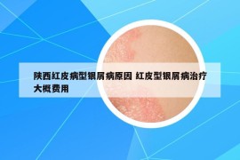 陜西紅皮病型銀屑病原因 紅皮型銀屑病治療大概費(fèi)用