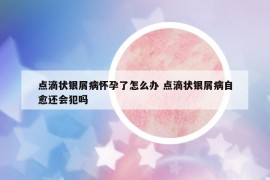 點滴狀銀屑病懷孕了怎么辦 點滴狀銀屑病自愈還會犯嗎