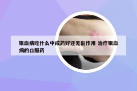 銀血病吃什么中成藥好還無副作用 治療銀血病的口服藥