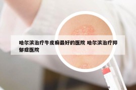 哈爾濱治療牛皮癬最好的醫(yī)院 哈爾濱治療抑郁癥醫(yī)院