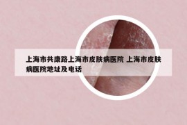上海市共康路上海市皮膚病醫(yī)院 上海市皮膚病醫(yī)院地址及電話