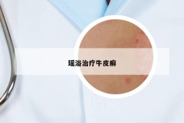 瑤浴治療牛皮癬