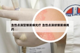 急性點(diǎn)滴型銀屑病光療 急性點(diǎn)滴狀銀屑病用藥