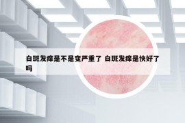 白斑發(fā)癢是不是變嚴(yán)重了 白斑發(fā)癢是快好了嗎