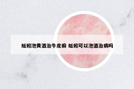 蚯蚓泡黃酒治牛皮癬 蚯蚓可以泡酒治病嗎