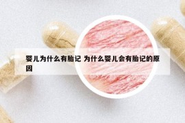 嬰兒為什么有胎記 為什么嬰兒會有胎記的原因