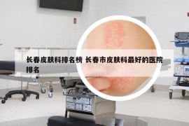 長春皮膚科排名榜 長春市皮膚科最好的醫(yī)院排名