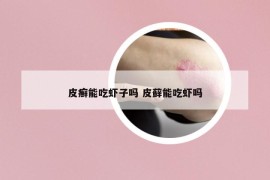 皮癬能吃蝦子嗎 皮蘚能吃蝦嗎