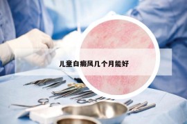 兒童白癜風幾個月能好