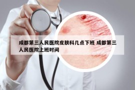 成都第三人民醫(yī)院皮膚科幾點下班 成都第三人民醫(yī)院上班時間