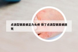 點(diǎn)滴型銀屑病乏力頭疼 得了點(diǎn)滴型銀屑病想死