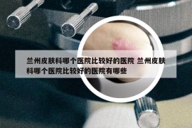 蘭州皮膚科哪個醫(yī)院比較好的醫(yī)院 蘭州皮膚科哪個醫(yī)院比較好的醫(yī)院有哪些
