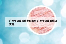 廣州中研皮膚病?？漆t(yī)院 廣州中研皮膚病研究院