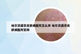 哈爾濱盛京皮膚病醫(yī)院怎么樣 哈爾濱盛京皮膚病醫(yī)院官網(wǎng)