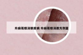 升麻葛根湯銀屑病 升麻葛根湯原方劑量