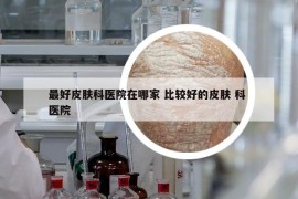 最好皮膚科醫(yī)院在哪家 比較好的皮膚 科 醫(yī)院