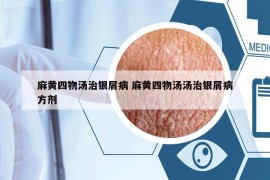 麻黃四物湯治銀屑病 麻黃四物湯湯治銀屑病方劑