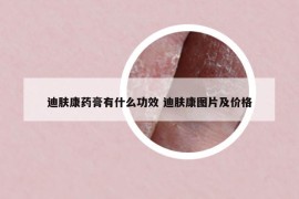 迪膚康藥膏有什么功效 迪膚康圖片及價格