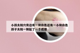 小孩太陽穴旁邊有一塊白色還有一小塊白色 孩子太陽一側起了一個疙瘩